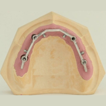 Pakistan, Attacco A Un Posto Di Blocco: Uccisi Due Poliziotti - Foto 10